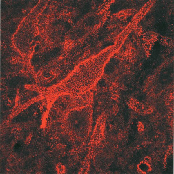 AntiChondroitin Sulfate Proteoglycan Antibody, Brain (core protein
